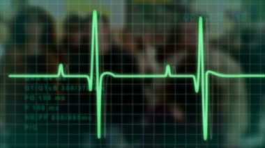 Electrocardiogram pulse trace
