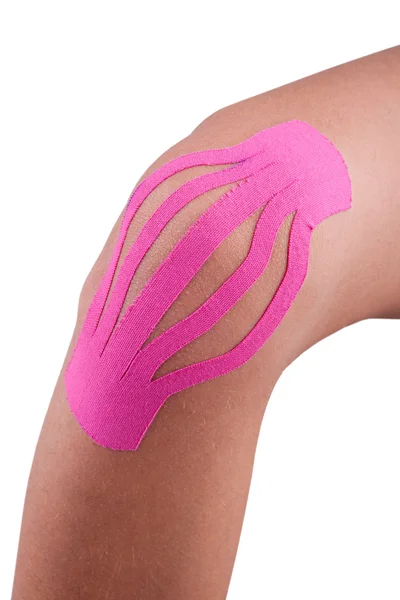 Knee treated with kinesio therapy — Stock Photo, Image