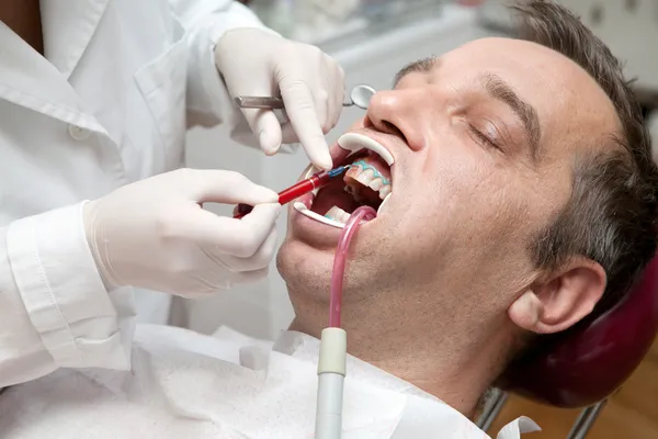Homem durante o processo de clareamento dos dentes no consultório odontológico — Fotografia de Stock