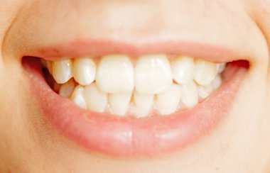 Dişler Gülümseyin