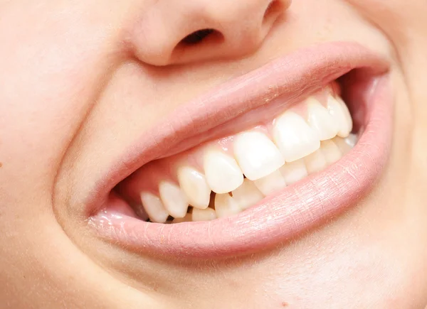 Zdravé zuby — Stock fotografie