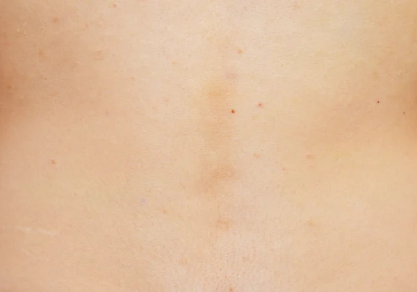 Human skin — Stock Photo, Image