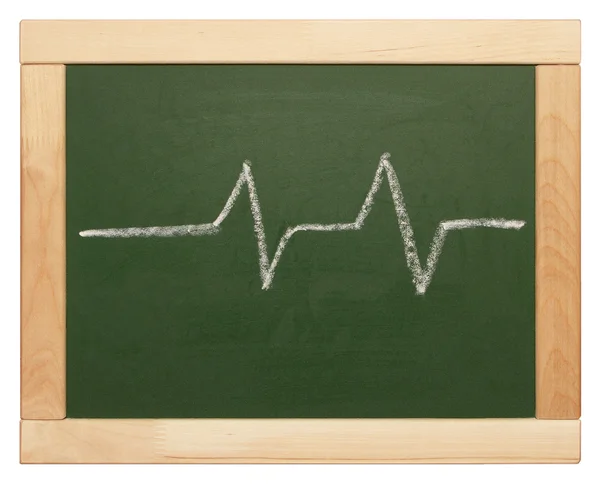 Heartbeat sign — Stock Photo, Image