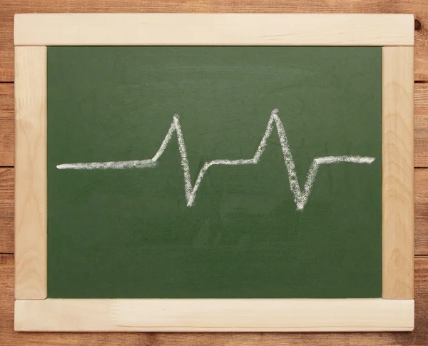 Heartbeat знак — стокове фото