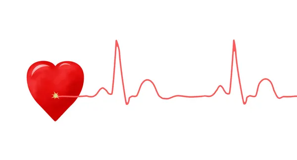 EKG-grafikon és a szív — Stock Fotó