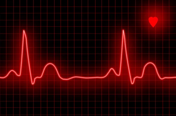 ECG graph and heart — Stock Photo, Image