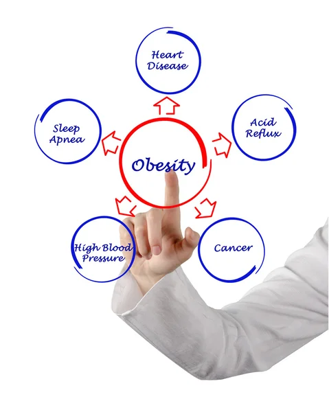 Obesity — Stock Photo, Image