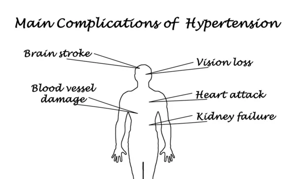 Main complications of hypertension — Stock Photo, Image