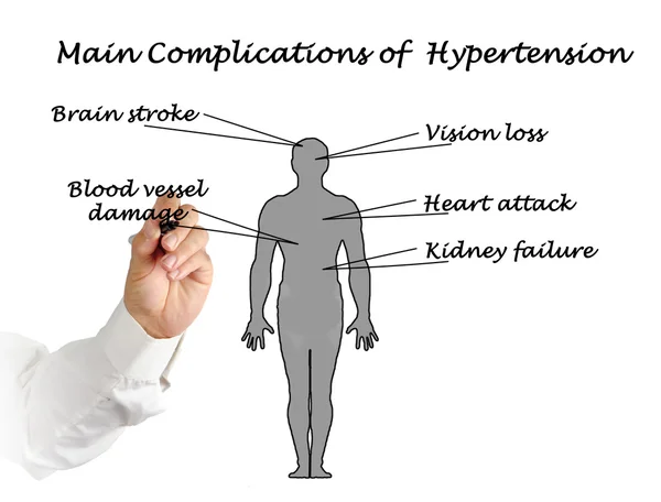 Hipertansiyon ana komplikasyonlar — Stok fotoğraf