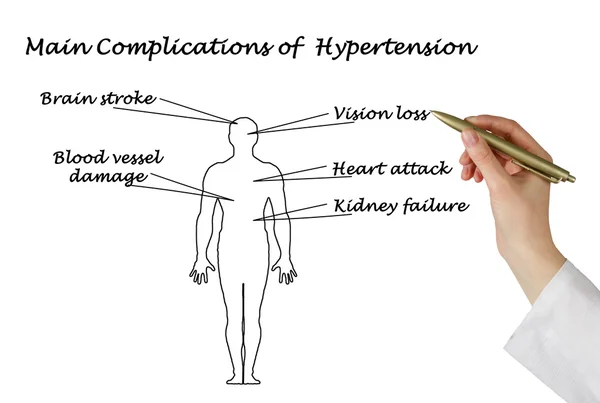 Belangrijkste complicaties van hypertensie — Stockfoto