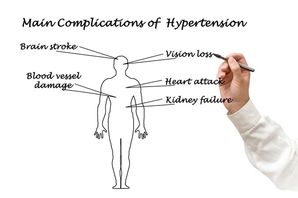 Hipertansiyon ana komplikasyonlar — Stok fotoğraf