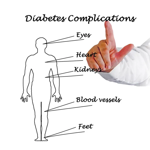Complicații ale diabetului — Fotografie, imagine de stoc