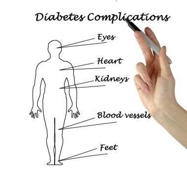 diabetes complications clipart
