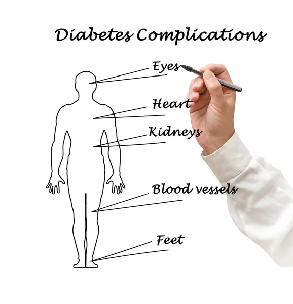 Factores de riesgo de diabetes —  Fotos de Stock