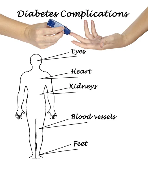 Diabetes-Risikofaktoren — Stockfoto