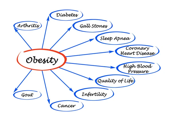 Diagrama de la obesidad — Foto de Stock