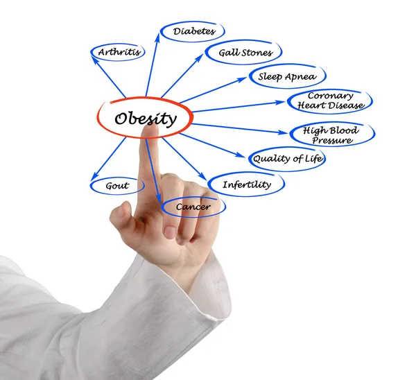 Diagrama de obesidade — Fotografia de Stock