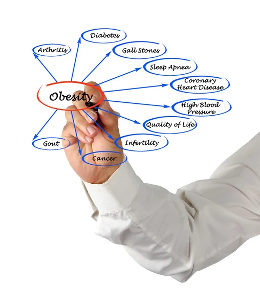 Diagrama de obesidade — Fotografia de Stock