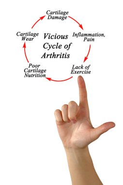 Vicious Cycle of Arthritis 'teki Adımlar
