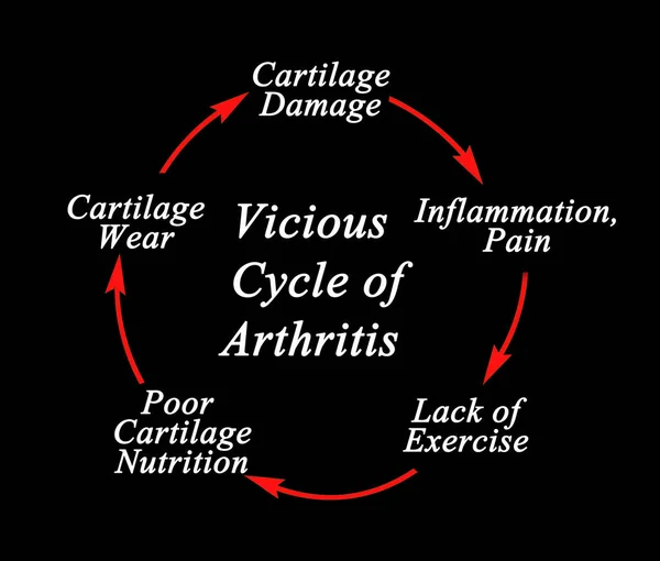Vicious Cycle Arthritis Teki Adımlar — Stok fotoğraf