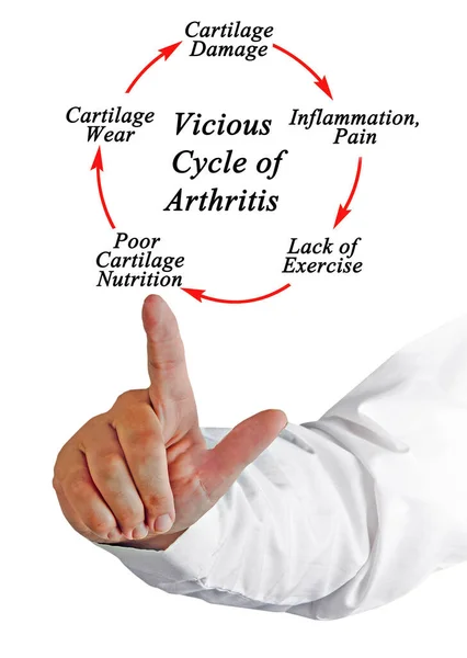 Schritte Teufelskreis Der Arthritis — Stockfoto