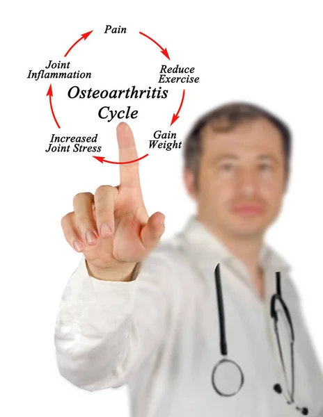 Vijf Componenten Van Osteoartritis Cyclus — Stockfoto