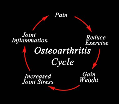 Osteoartrit döngüsünün beş bileşeni