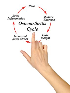 Osteoartrit döngüsünün beş bileşeni