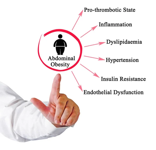 Έξι Κίνδυνοι Της Κοιλιακής Παχυσαρκίας — Φωτογραφία Αρχείου