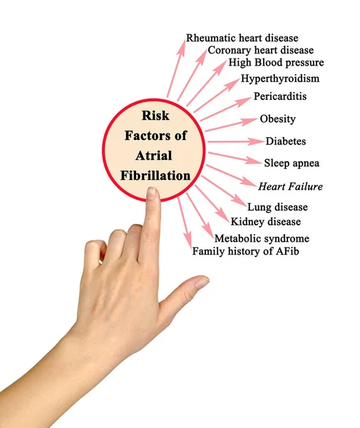 Risk Factors Atrial Fibrilation — Stock Photo, Image