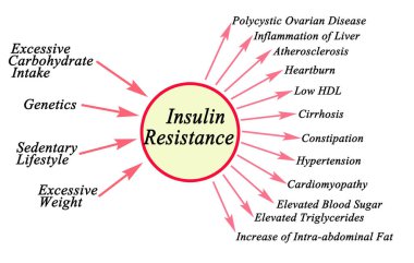 Causes and consequences of Insulin Resistance clipart