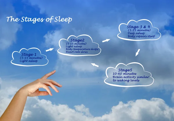 Four Stages Normal Sleep — Stock Photo, Image