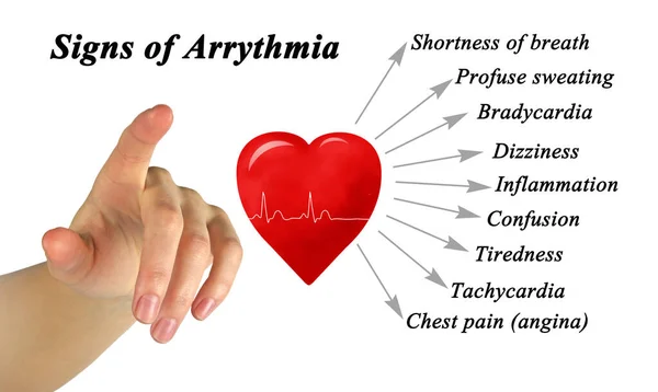 Presenting Nine Sign Arrythmia — ストック写真
