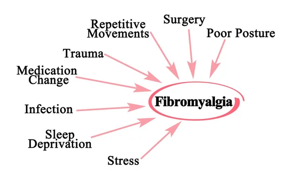 Ocho Desencadenantes Fibromialgia — Foto de Stock