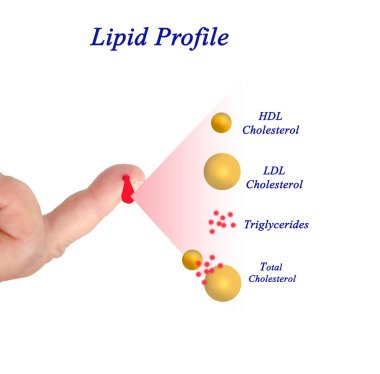 İstenilen Lipid profili aralığı 