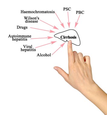 Eight major causes of Cirrhosis clipart