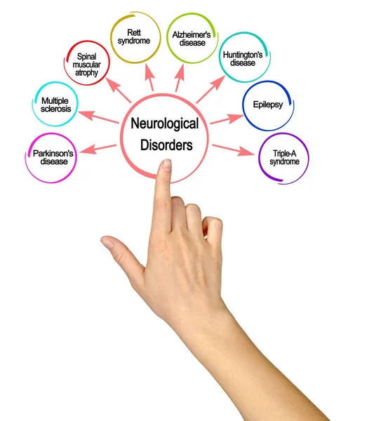 Γυναίκα Παρουσιάζει Οκτώ Νευρολογικές Διαταραχές — Φωτογραφία Αρχείου