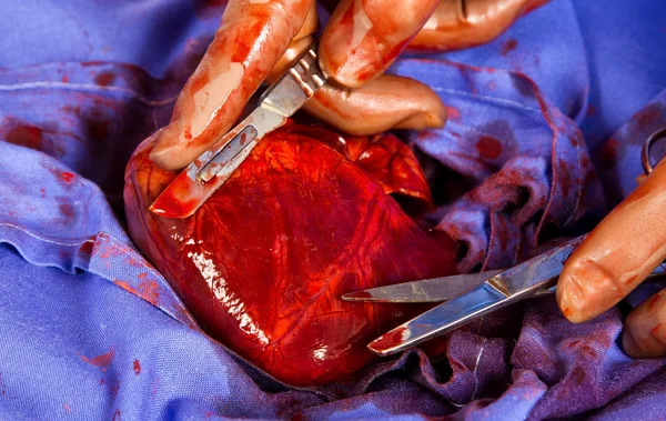 Nahaufnahme der Herzopearation — Stockfoto