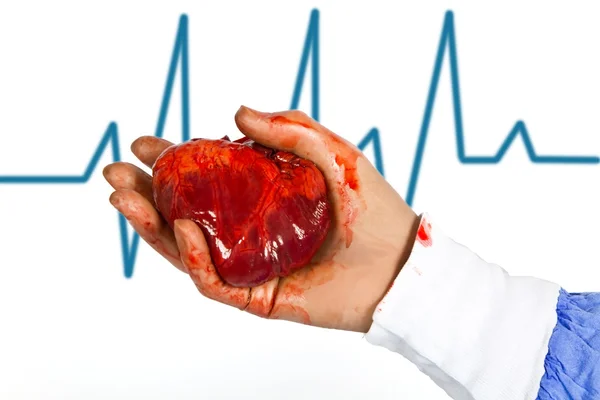 Segnale cuore ed ecg — Foto Stock