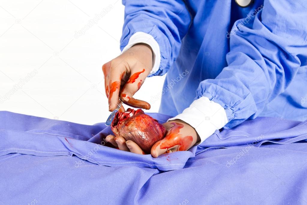 Doctor busy with heart operation