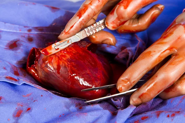 Врач, оперирующий сердце пациента — стоковое фото