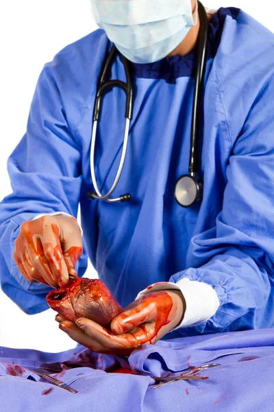 Doctor operating on patient heart — Stock Photo, Image