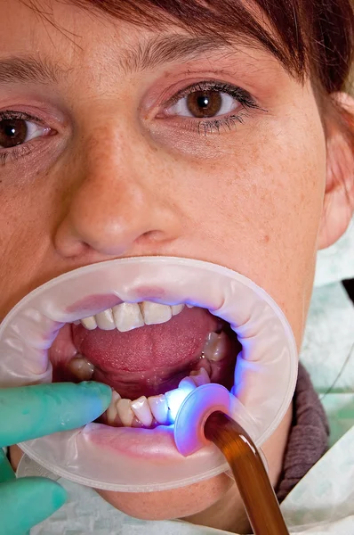 De tandarts — Stockfoto