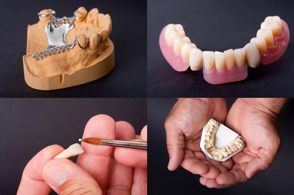 Modelos de cera dentária para o tema do dentista — Fotografia de Stock