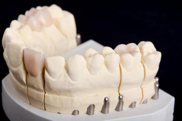 Dental wax model — Stock Photo, Image