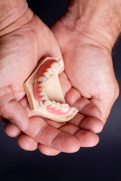 Dental wax model — Stock Photo, Image