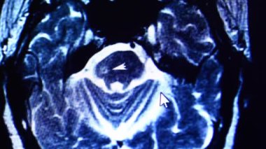 MRI tarama bilgisayar monitör üzerinde