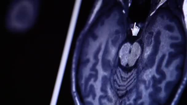 Exploración por resonancia magnética en el monitor del ordenador — Vídeo de stock