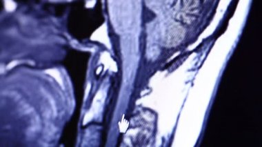 MRI tarama bilgisayar monitör üzerinde