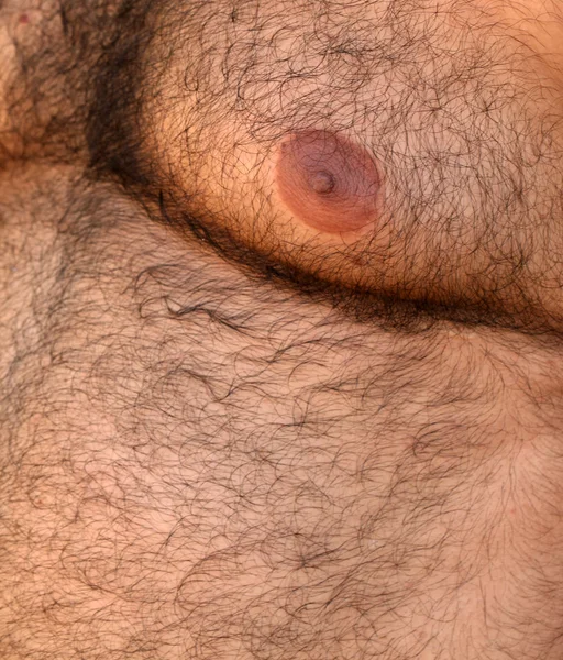 Hairy skin — Stock Photo, Image